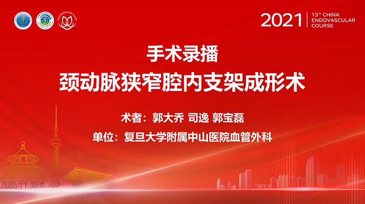 复旦中山&mdash;颈动脉狭窄腔内支架成形术