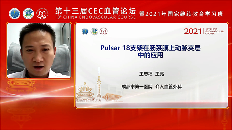 Pulsar-18支架在肠系膜上动脉夹层中的应用