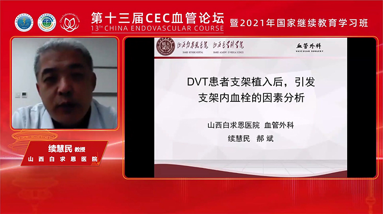 深静脉血栓-DVT患者支架植入后，引发支架内血栓的因素分析-续慧民