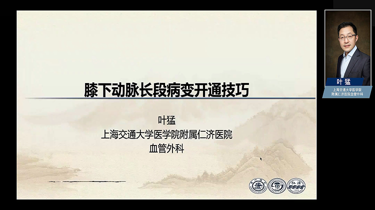 膝下动脉长段病变开通技巧-叶猛