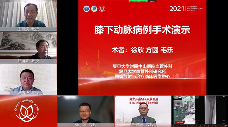 复旦中山&mdash;膝下动脉病例手术演示