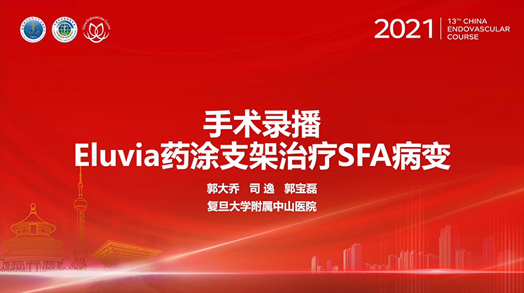 复旦中山&mdash;Eluvia药涂支架治疗SFA 病变