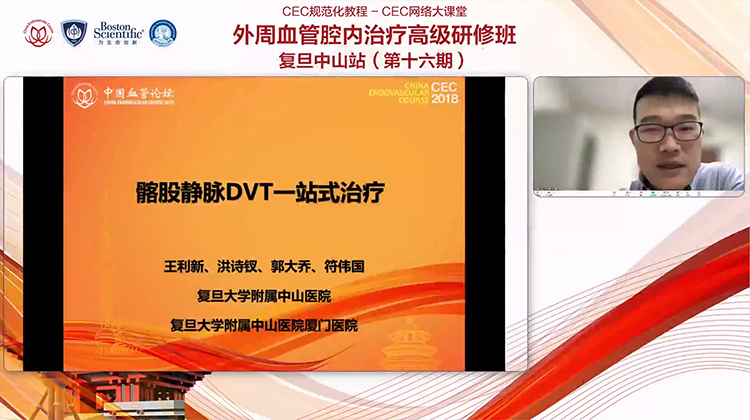 髂股静脉DVT的一站式治疗