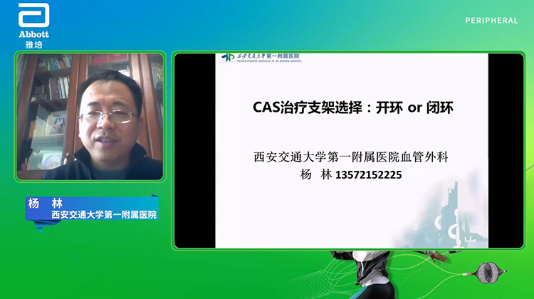 CAS治疗支架选择：开环or闭环-杨林