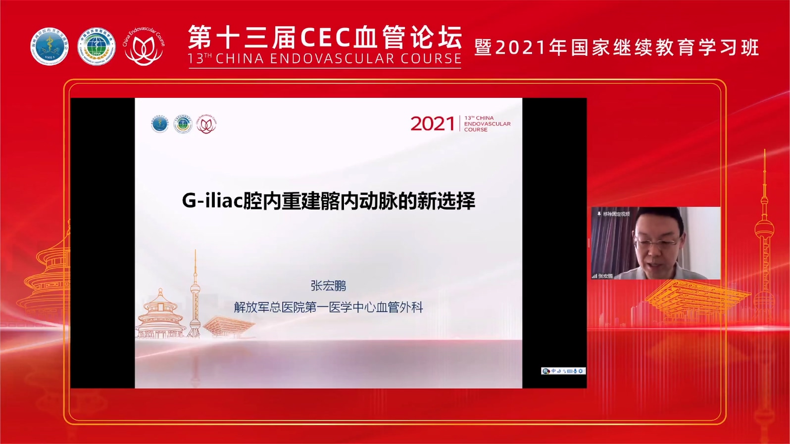 G-iliac&mdash;腔内重建髂内动脉的新选择-张宏鹏