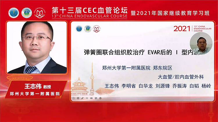 &ldquo;弹簧圈+组织胶&rdquo;治疗EVAR术后I型内漏-王志伟