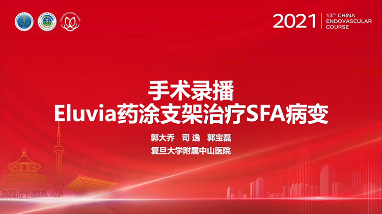复旦中山&mdash;Eluvia药涂支架治疗SFA病变