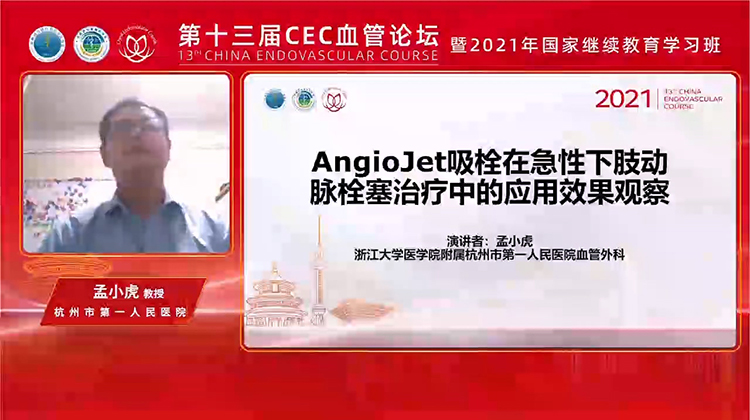 AngioJet吸栓在急性下肢动脉栓塞治疗中的应用效果观察-孟小虎