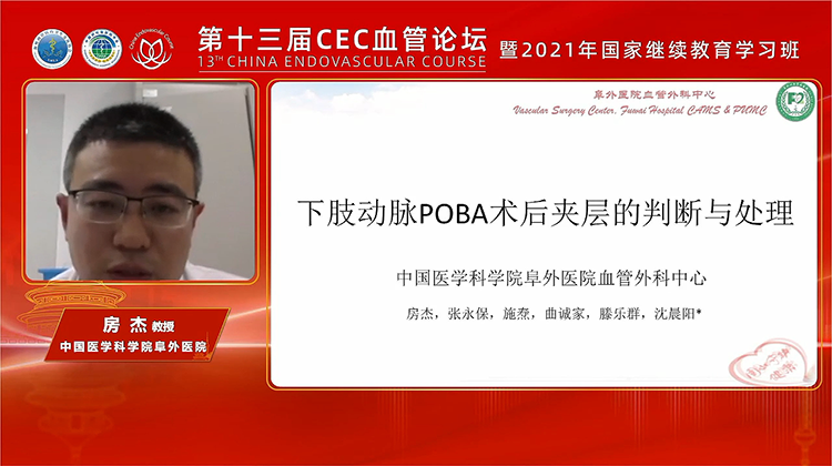 下肢动脉POBA术后夹层的判断与处理-房杰
