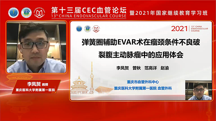 弹簧圈辅助EVAR术在瘤颈条件不良破裂腹主动脉瘤中的应用体会-李凤贺 