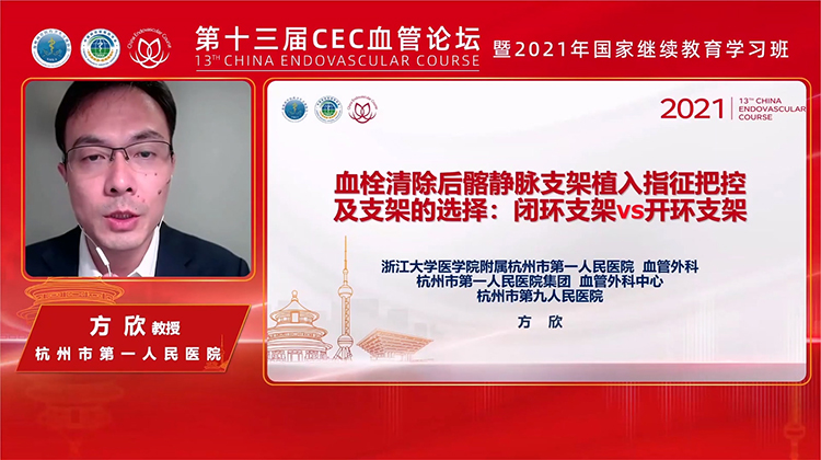 血栓清除后髂静脉支架植入指征把控及支架的选择：闭环支架vs开环支架-方欣