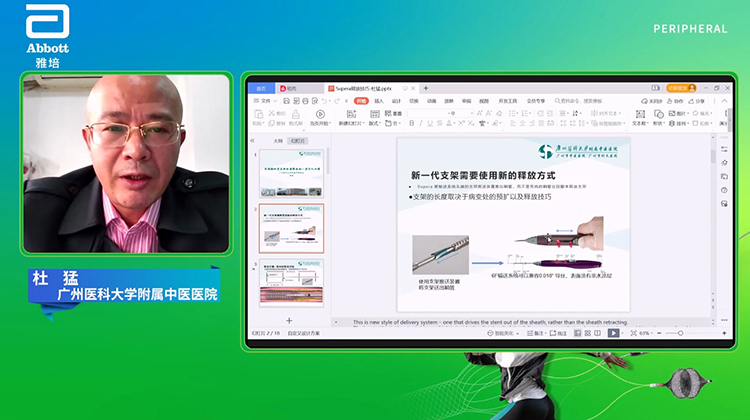 编织型支架精准释放技巧解析-杜猛
