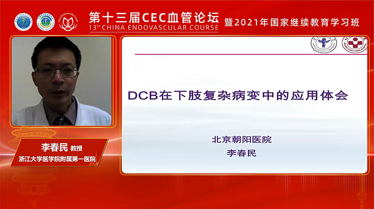 DCB在下肢复杂病变中的应用体会-李春民