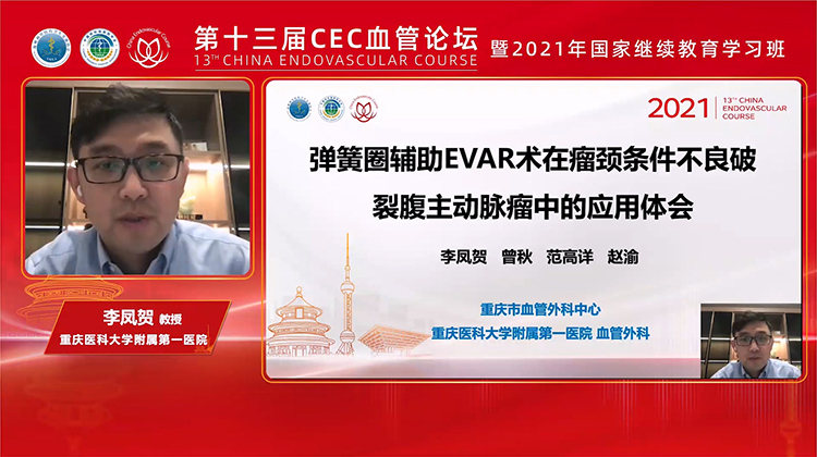 弹簧圈辅助EVAR术在瘤颈条件不良破裂腹主动脉瘤中的应用体会-李凤贺