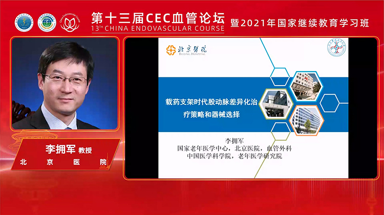 载药支架时代股浅动脉差异化治疗策略和器械选择-李拥军