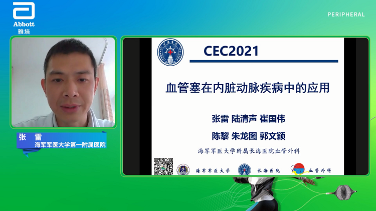 血管塞在内脏动脉疾病中的应用-张雷