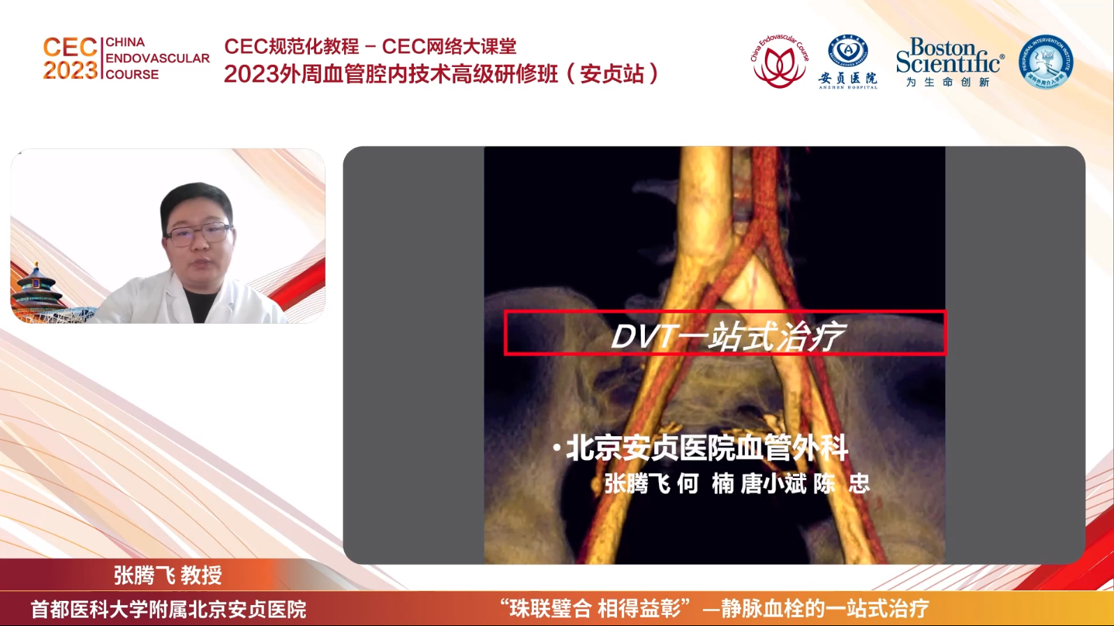 DVT一站式治疗-张腾飞