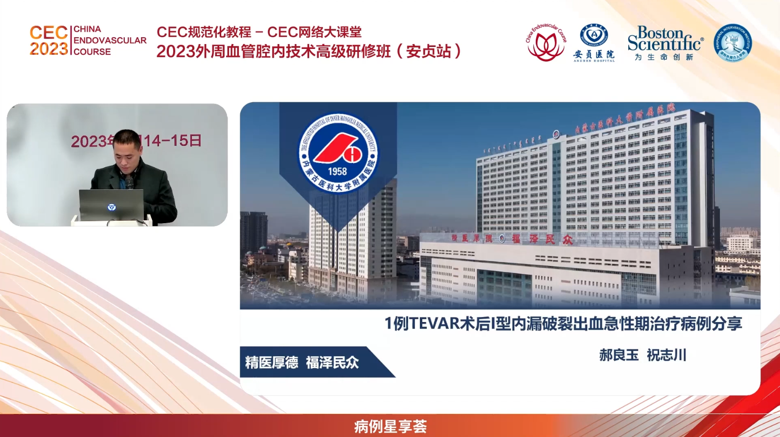 1例TEVAR术后I型内漏破裂出血急性期治疗病例分享 - 内蒙古医科大学附属医院-祝志川