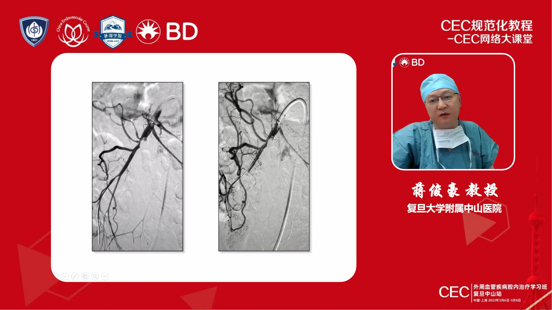 2023-03-07-蒋俊豪