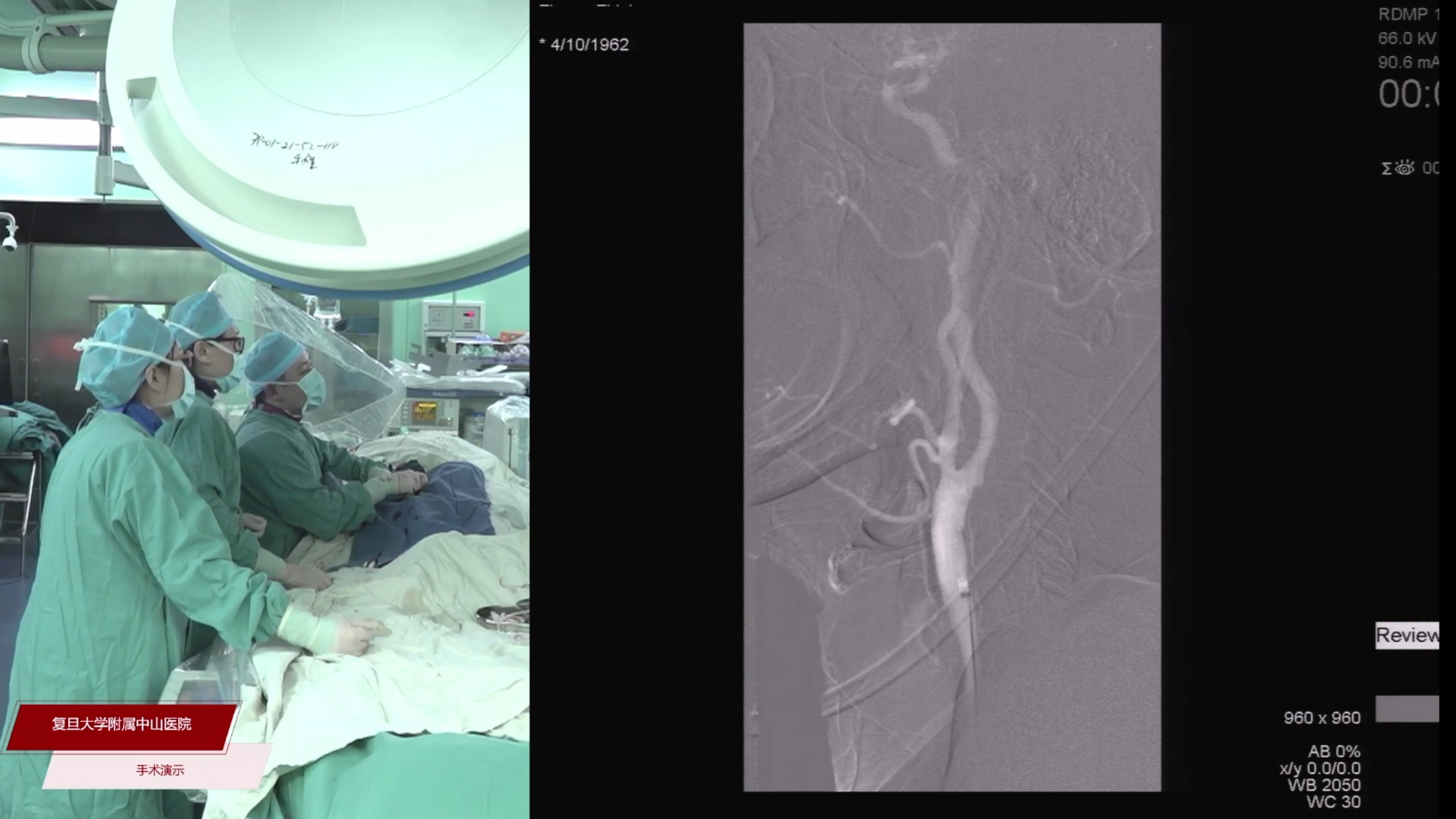 2023-03-08-手术（三）