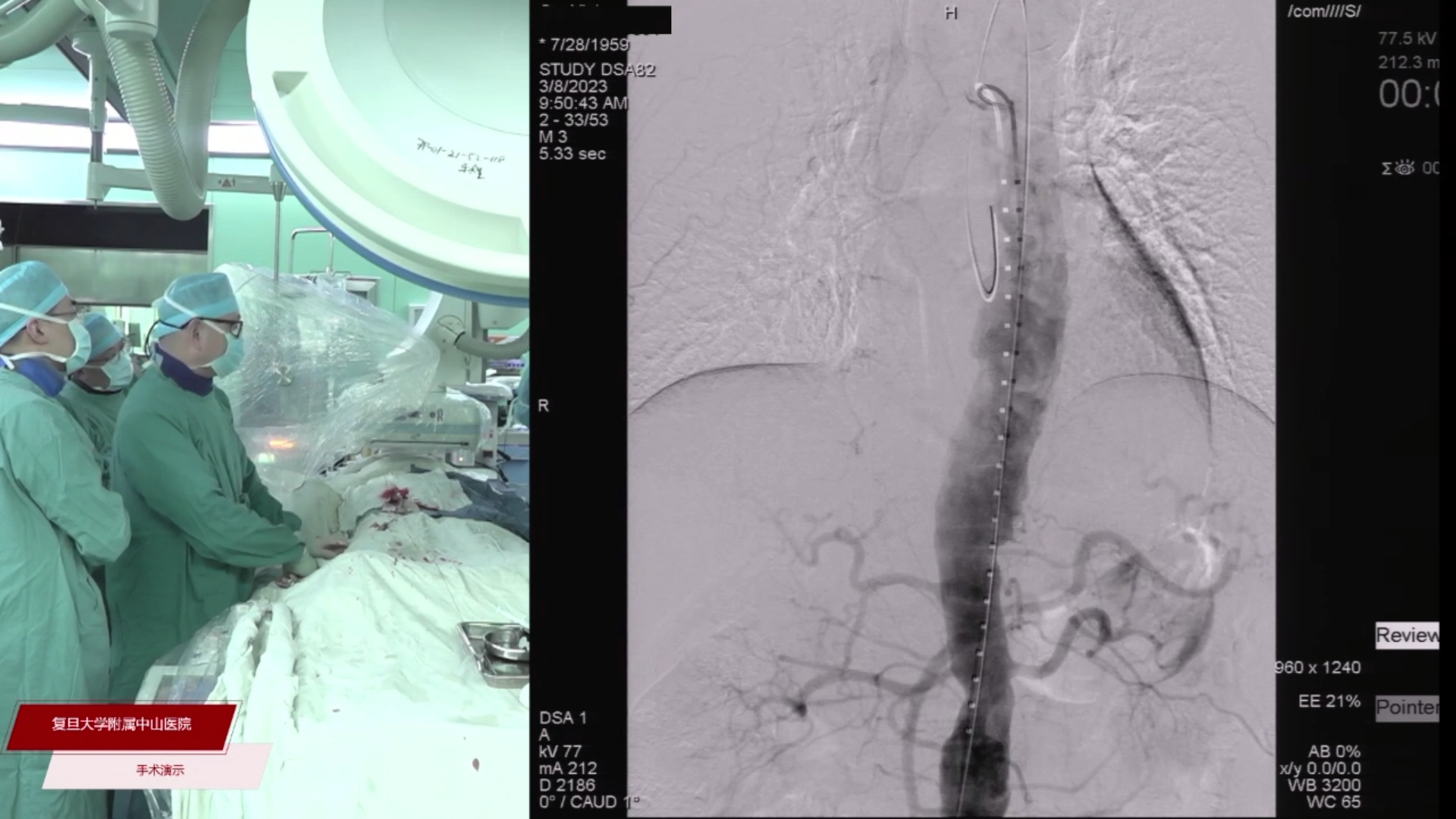 2023-03-08-手术（一）