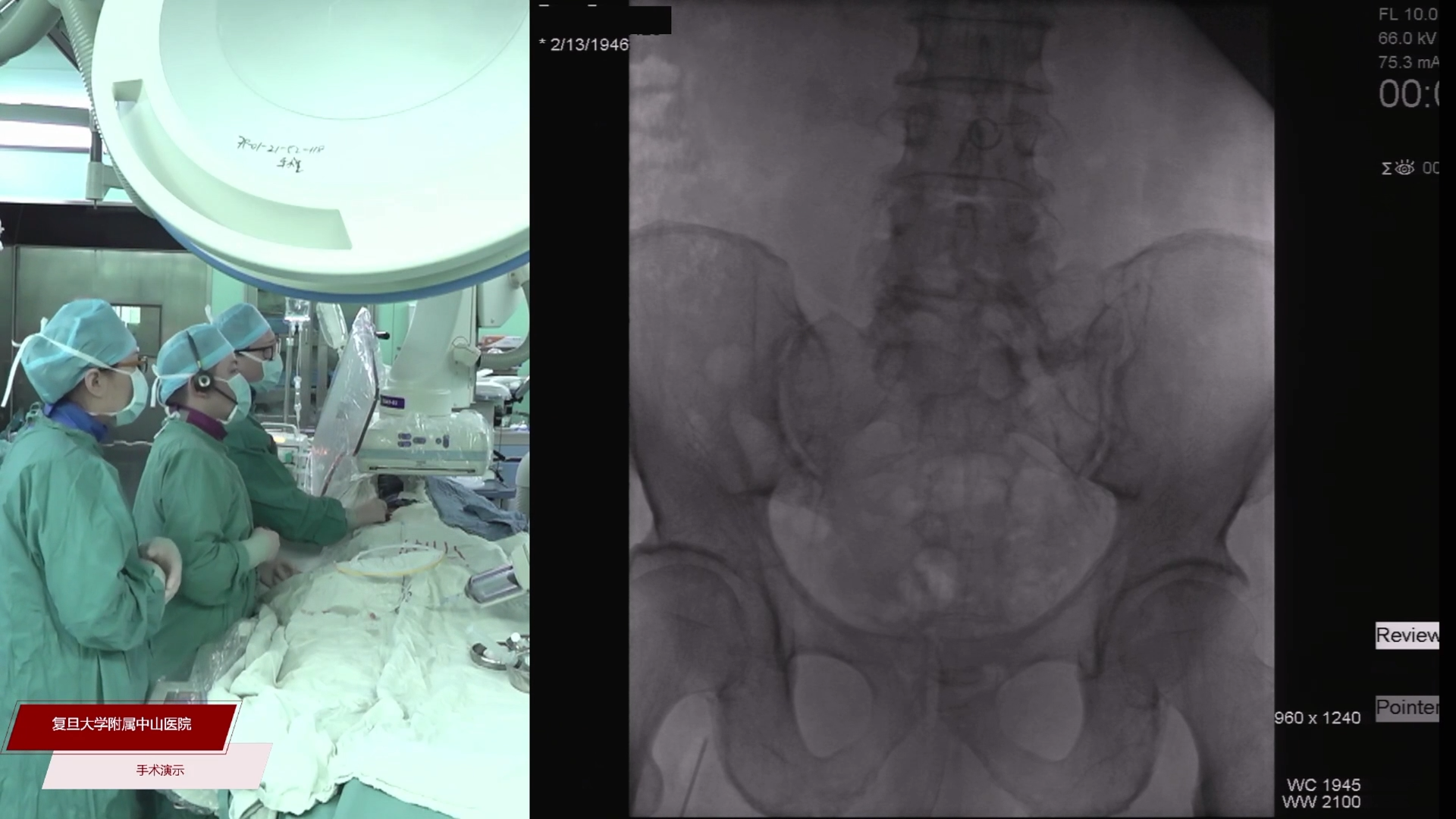2023-03-08-手术（二）