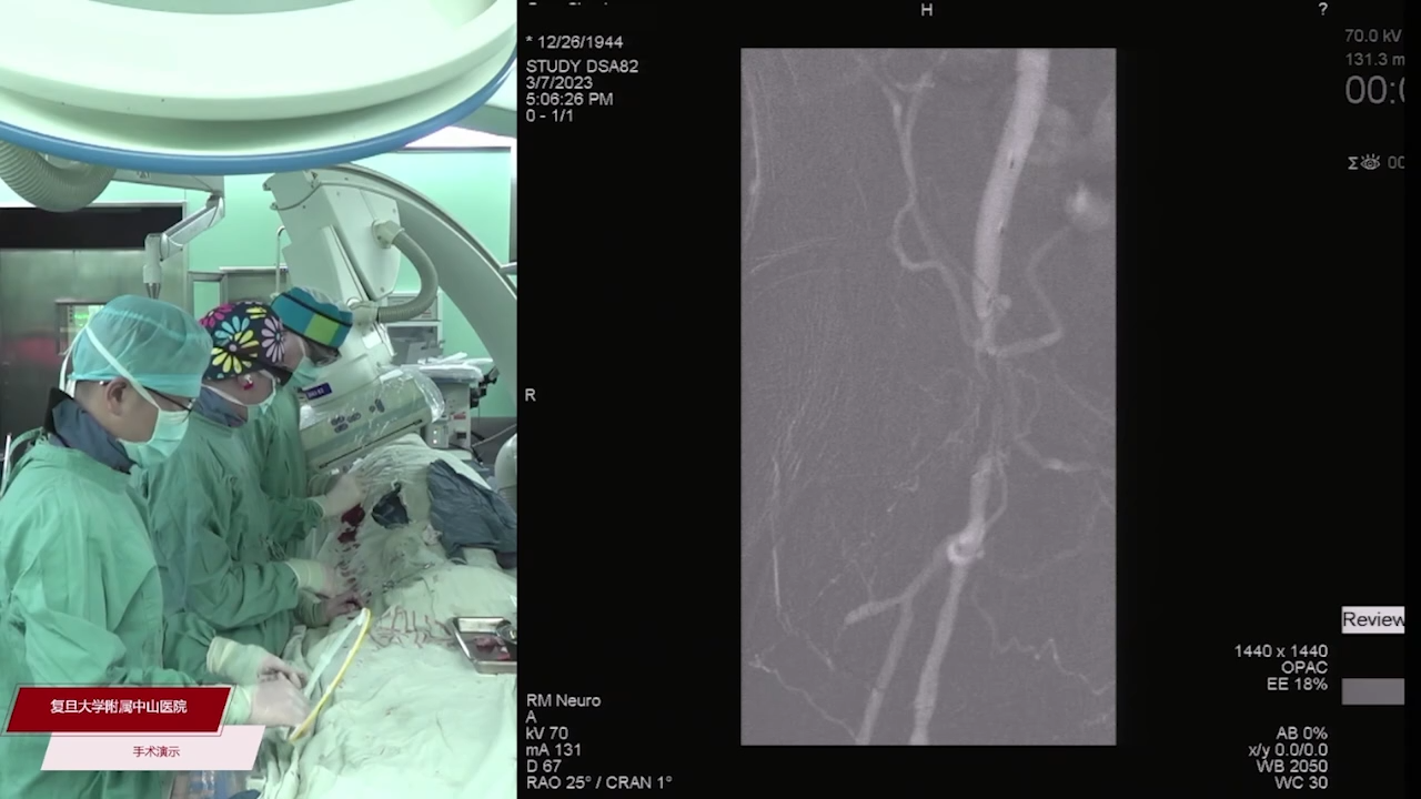 2023-03-07-手术（三）