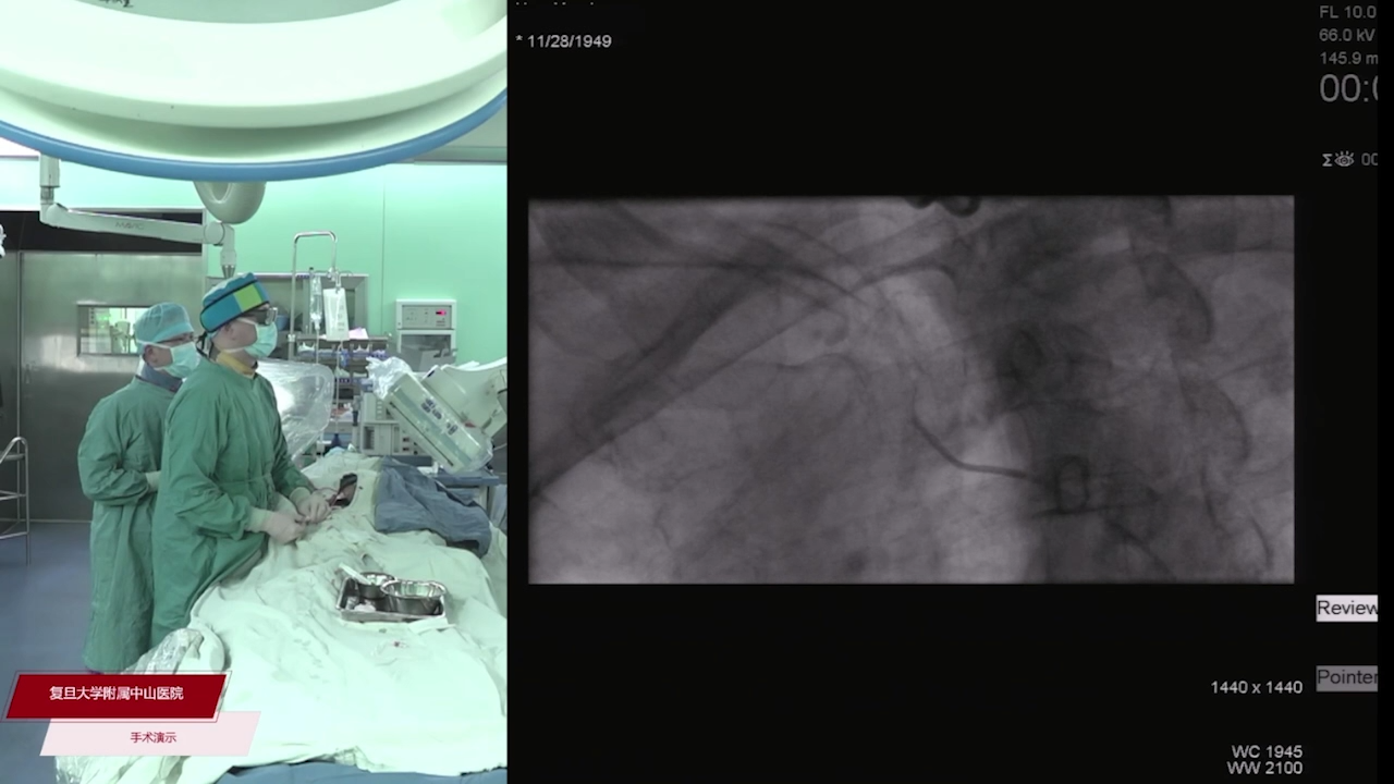 2023-03-07-手术（一）