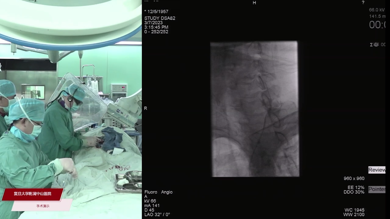 2023-03-07-手术（二）