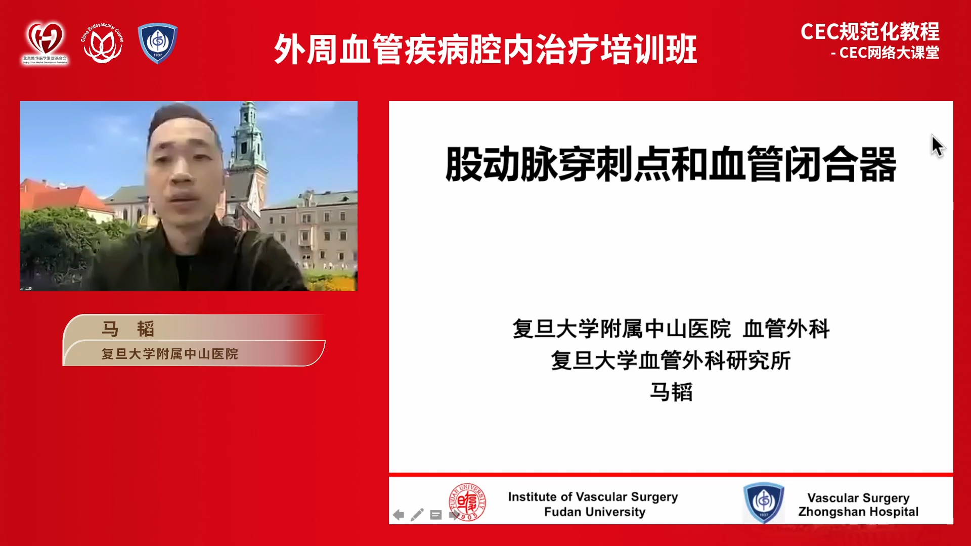 2023-03-14 股动脉穿刺点和血管闭合器-马韬