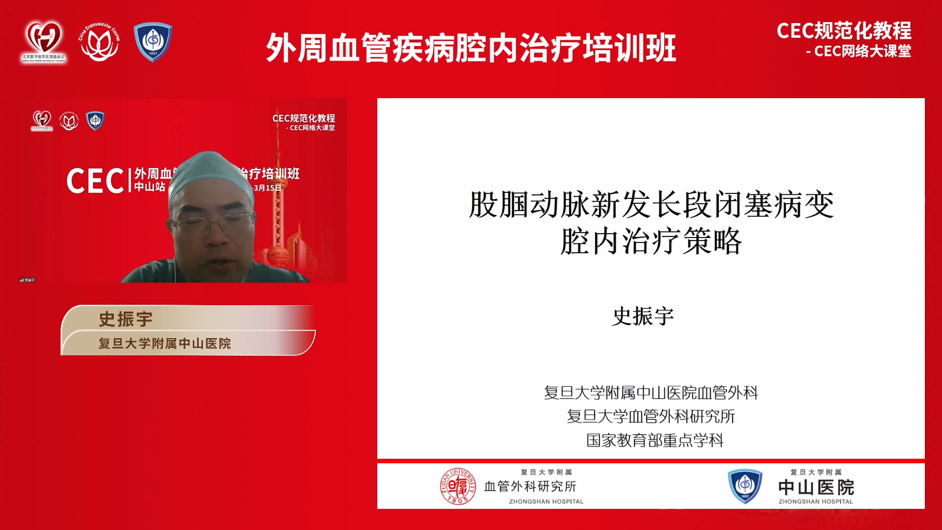 2023-03-13 股腘动脉新发长段闭塞病变腔内治疗策略-史振宇