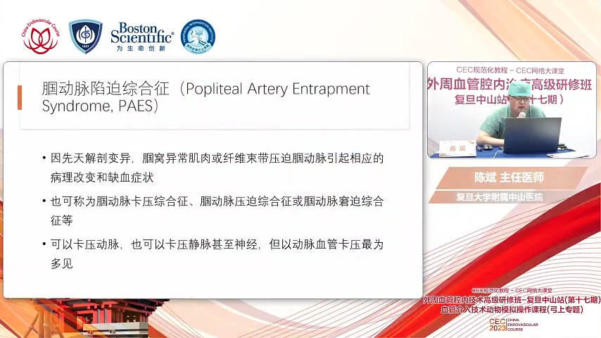 胭动脉陷迫综合征(Popliteal Artery EntrapmentSyndrome，PAES)-陈斌