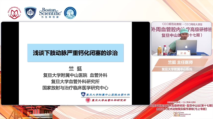 浅谈下肢动脉严重钙化闭塞的诊治-竺挺