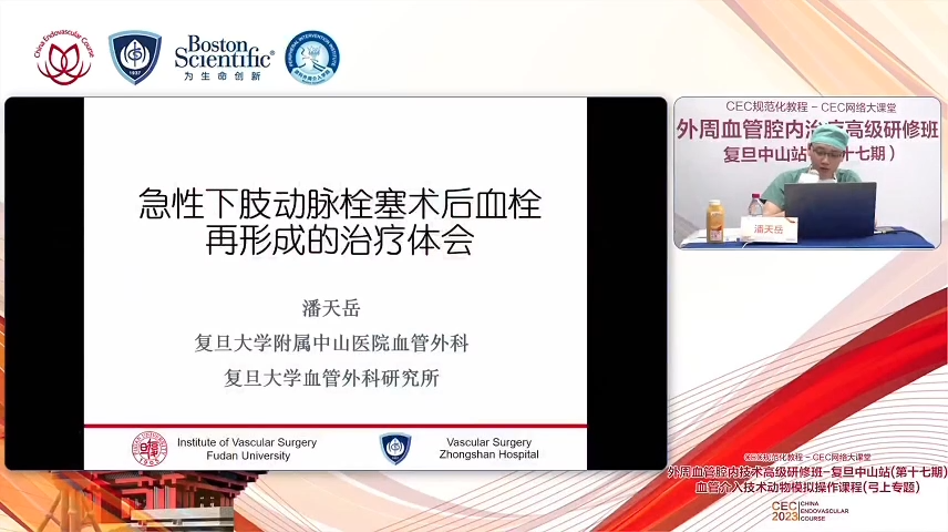 急性下肢动脉栓塞术后血栓再形成的治疗体会-潘天岳