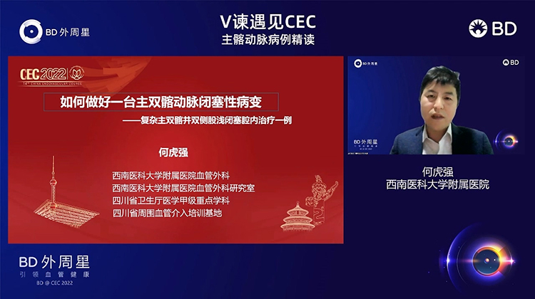 如何做好一台主双髂动脉闭塞性动脉&mdash;&mdash;复杂主双髂并双侧浅闭塞腔内治疗一例-何虎强