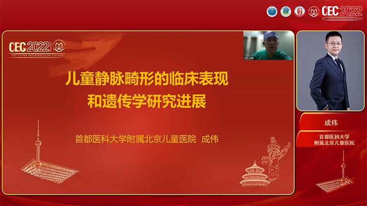 儿童静脉畸形的临床表现和遗传学研究进展-成伟