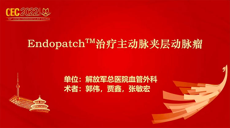Endopatch&trade;治疗主动脉夹层动脉瘤-郭伟 贾鑫