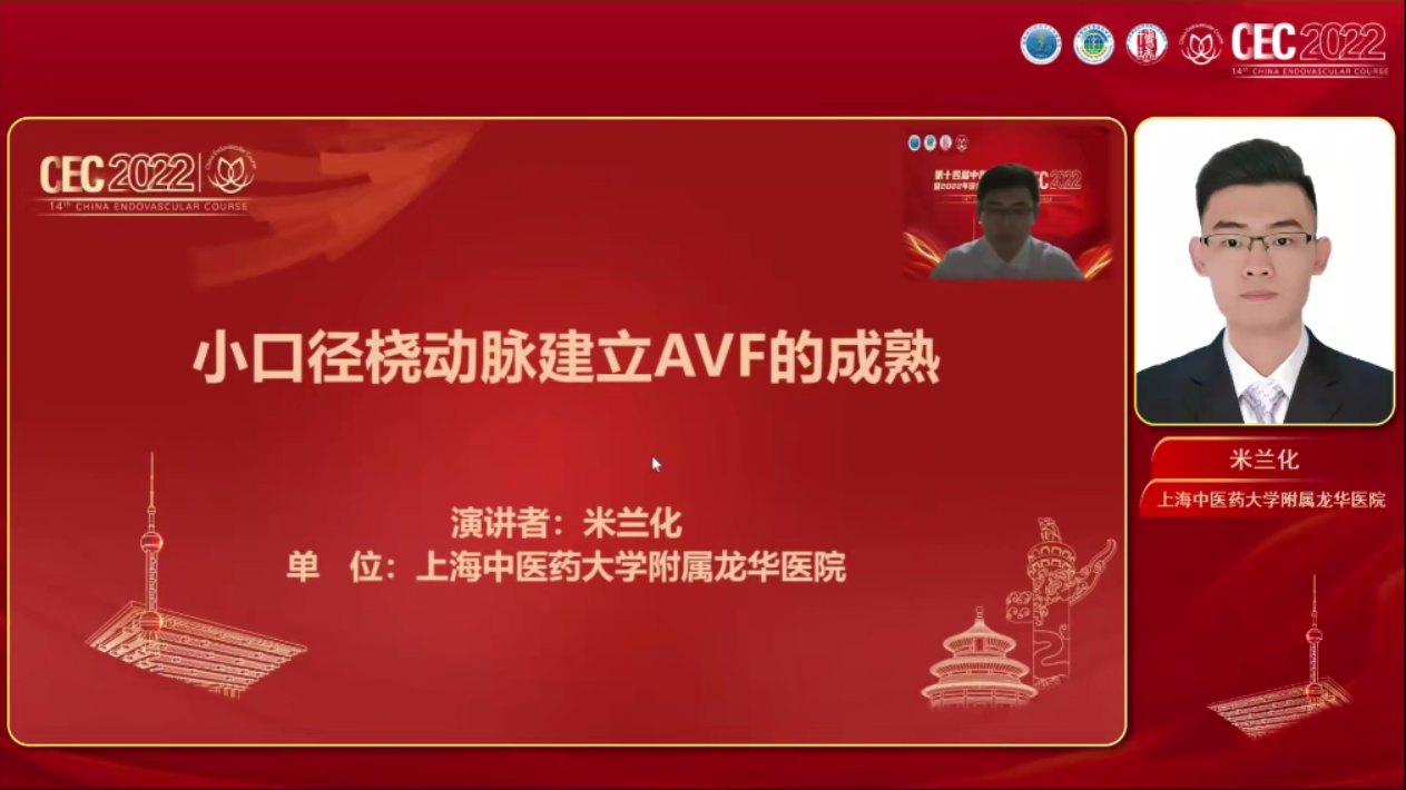 小口径桡动脉建立AVF的成熟-米兰化