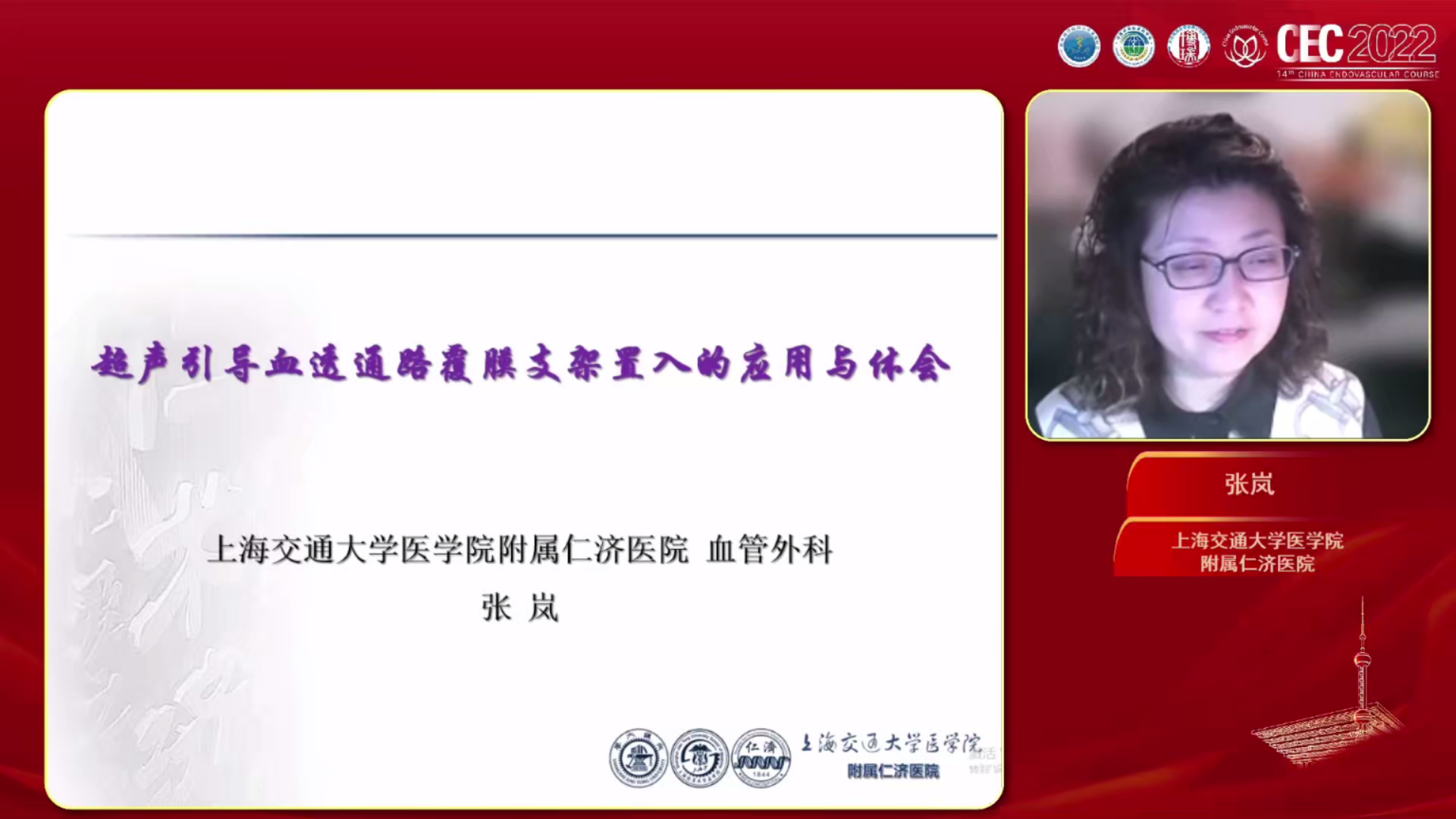 超声辅助在血透通路覆膜支架置入术中的应用-张岚