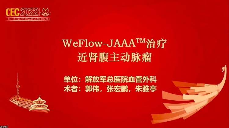 WeFlow-JAAA治疗近肾腹主动脉瘤-郭伟 张宏鹏