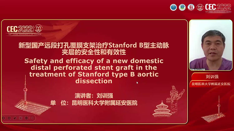 新型国产远段打孔覆膜支架治疗Stanford B型 主动脉夹层的安全性和有效性-刘训强