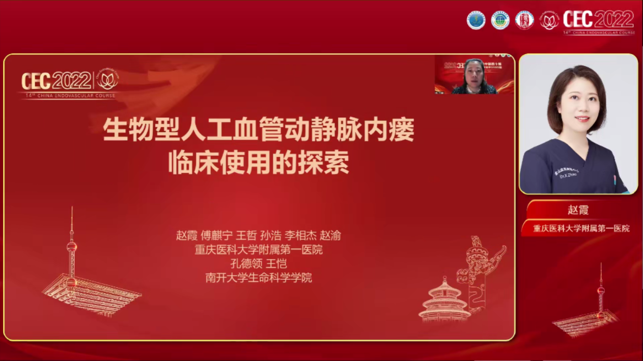 生物型人工血管动静脉内瘘临床使用的探索-赵霞