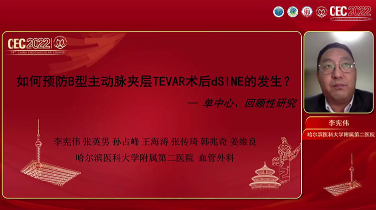 如何预防B型主动脉夹层TEVAR术后dSINE的发生？&mdash;&mdash;单中心回顾性研究-李宪伟
