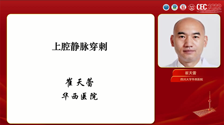 上腔静脉穿刺的安全性分析-崔天蕾