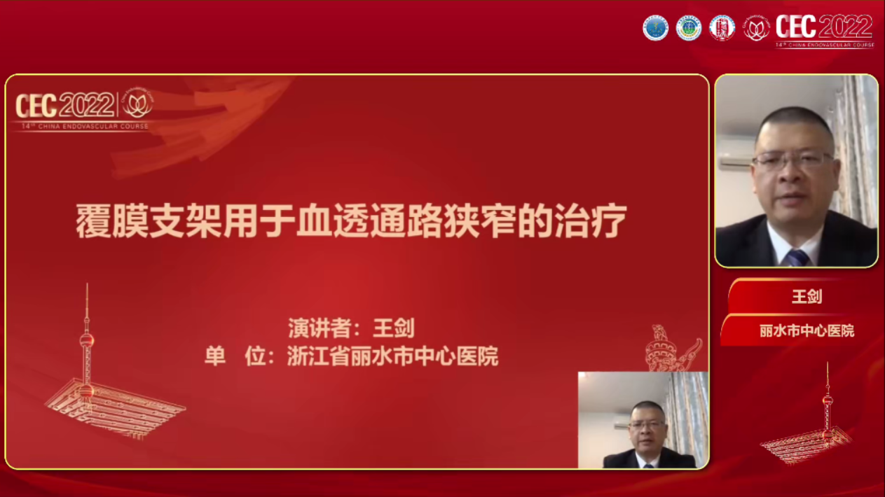 覆膜支架用于血透通路狭窄的治疗-王剑