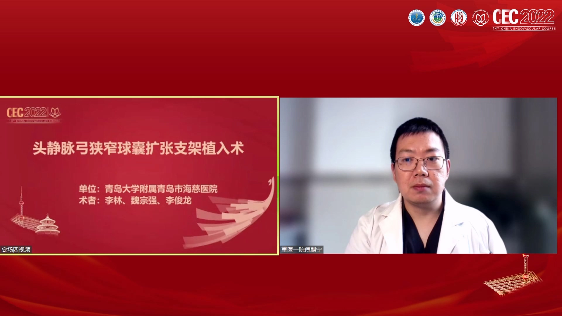 头静脉弓狭窄球囊扩张植入术-李林