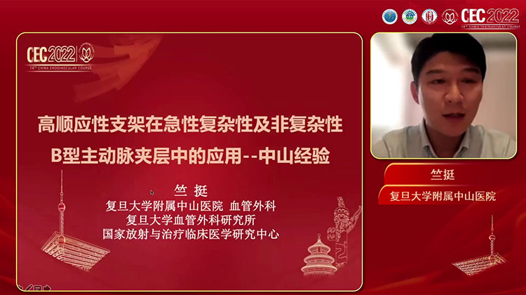 高顺应性支架型人工血管在急性TBAD中的应用&mdash;中山经验-竺挺