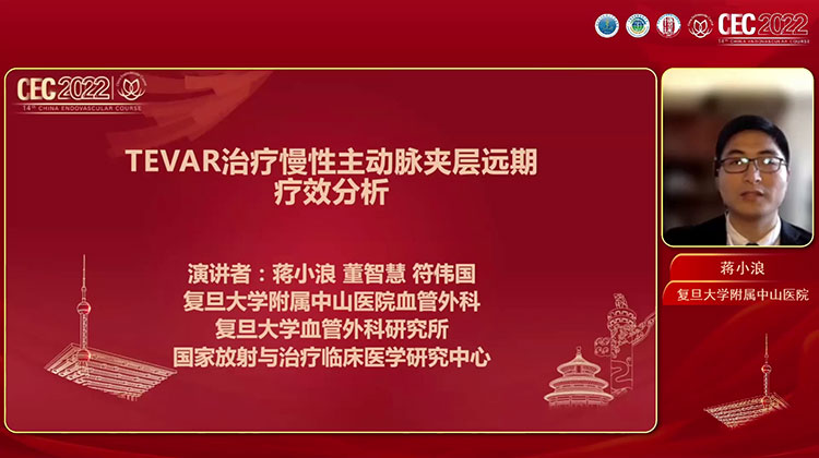 腔内修复治疗慢性主动脉夹层的长期疗效-蒋小浪