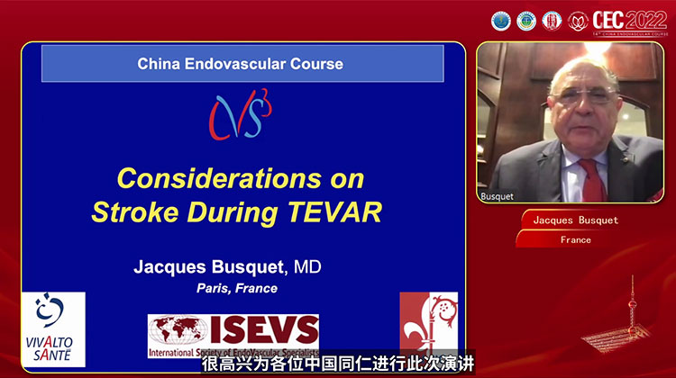 关于胸主动脉腔内修复（TEVAR）术中中风的思考 Considerations on Stroke during TEVAR-Jacques Busquet