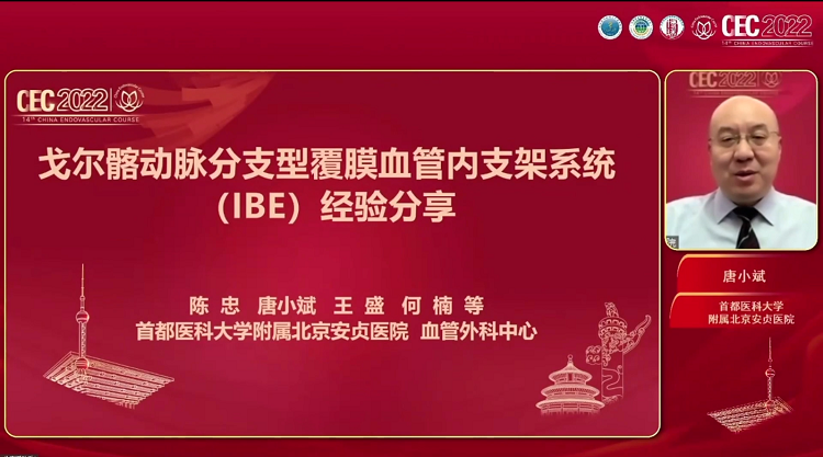 戈尔髂动脉分支型覆膜血管内支架系统（IBE）经验分享-唐小斌